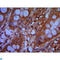 Chromodomain Helicase DNA Binding Protein 3 antibody, LS-C812914, Lifespan Biosciences, Immunohistochemistry paraffin image 