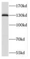 Transforming Acidic Coiled-Coil Containing Protein 3 antibody, FNab08469, FineTest, Western Blot image 