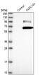 C-Type Lectin Domain Containing 14A antibody, PA5-58798, Invitrogen Antibodies, Western Blot image 