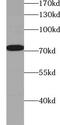 ZXD Family Zinc Finger C antibody, FNab09763, FineTest, Western Blot image 