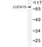 RNA Binding Motif Protein 5 antibody, LS-C177017, Lifespan Biosciences, Western Blot image 