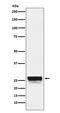 Chymotrypsin Like antibody, M08534, Boster Biological Technology, Western Blot image 