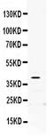 Paraoxonase 2 antibody, PB9779, Boster Biological Technology, Western Blot image 