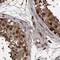 RAD23 Homolog B, Nucleotide Excision Repair Protein antibody, NBP1-89699, Novus Biologicals, Immunohistochemistry paraffin image 
