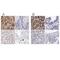 Galactosidase Alpha antibody, NBP1-89796, Novus Biologicals, Immunohistochemistry paraffin image 