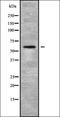 Interleukin-28 receptor subunit alpha antibody, orb336293, Biorbyt, Western Blot image 