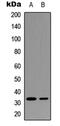 Insulin Like Growth Factor Binding Protein 3 antibody, abx121624, Abbexa, Western Blot image 