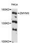 Zinc Finger MYM-Type Containing 3 antibody, LS-C748058, Lifespan Biosciences, Western Blot image 