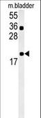 Coiled-Coil Domain Containing 12 antibody, LS-C168392, Lifespan Biosciences, Western Blot image 