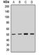 Eukaryotic Translation Initiation Factor 2B Subunit Gamma antibody, LS-C668810, Lifespan Biosciences, Western Blot image 