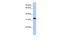 Calcium Voltage-Gated Channel Auxiliary Subunit Gamma 4 antibody, PA5-41037, Invitrogen Antibodies, Western Blot image 