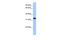 Calcium Voltage-Gated Channel Auxiliary Subunit Gamma 4 antibody, PA5-41037, Invitrogen Antibodies, Western Blot image 