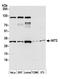 Nitrilase Family Member 2 antibody, A305-781A-M, Bethyl Labs, Western Blot image 