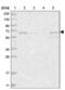 MINDY Lysine 48 Deubiquitinase 1 antibody, NBP1-83758, Novus Biologicals, Western Blot image 