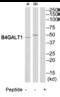 Beta-1,4-Galactosyltransferase 1 antibody, MBS004650, MyBioSource, Western Blot image 