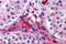 Dispatched RND Transporter Family Member 3 antibody, 4925, ProSci, Immunohistochemistry paraffin image 