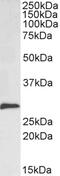 Snail Family Transcriptional Repressor 1 antibody, 46-392, ProSci, Enzyme Linked Immunosorbent Assay image 