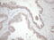 Heat Shock Transcription Factor 2 antibody, M04692, Boster Biological Technology, Immunohistochemistry paraffin image 