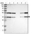 Secretory Carrier Membrane Protein 2 antibody, PA5-53215, Invitrogen Antibodies, Western Blot image 