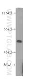 Interferon Regulatory Factor 2 antibody, 12525-1-AP, Proteintech Group, Western Blot image 