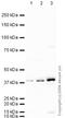 Adiponectin Receptor 1 antibody, ab70362, Abcam, Western Blot image 