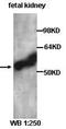 Argonaute RISC Component 4 antibody, orb77106, Biorbyt, Western Blot image 
