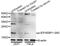 Eukaryotic Translation Initiation Factor 4E Binding Protein 1 antibody, MBS125564, MyBioSource, Western Blot image 
