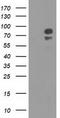 Oxysterol Binding Protein Like 11 antibody, TA501977, Origene, Western Blot image 