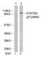 Mpf antibody, GTX78938, GeneTex, Western Blot image 
