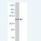 S100 Calcium Binding Protein A3 antibody, H00006274-M01, Novus Biologicals, Western Blot image 