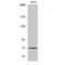 Protein Tyrosine Phosphatase Non-Receptor Type 11 antibody, LS-C386086, Lifespan Biosciences, Western Blot image 