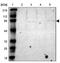 Radixin antibody, NBP1-85239, Novus Biologicals, Western Blot image 