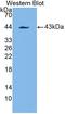 Platelet Derived Growth Factor Receptor Like antibody, LS-C687567, Lifespan Biosciences, Western Blot image 