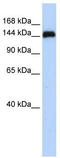 Gse1 Coiled-Coil Protein antibody, TA334556, Origene, Western Blot image 