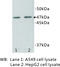 Transmembrane Protein 200A antibody, MBS355064, MyBioSource, Western Blot image 