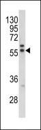 Melanoma antigen preferentially expressed in tumors antibody, MBS9211992, MyBioSource, Western Blot image 