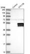 Serine/Threonine Kinase 17b antibody, NBP1-84980, Novus Biologicals, Western Blot image 