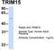 Tripartite Motif Containing 15 antibody, TA344443, Origene, Western Blot image 