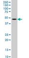 LIM/homeobox protein Lhx6 antibody, MA5-21649, Invitrogen Antibodies, Western Blot image 