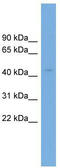 Arsenite Methyltransferase antibody, TA346809, Origene, Western Blot image 