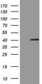 MAGE Family Member B3 antibody, TA808841, Origene, Western Blot image 
