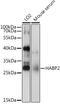 Hyaluronan Binding Protein 2 antibody, 22-555, ProSci, Western Blot image 