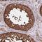 Tubulin Alpha 1c antibody, HPA039247, Atlas Antibodies, Immunohistochemistry paraffin image 