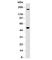 Carbonic Anhydrase 9 antibody, V7180-100UG, NSJ Bioreagents, Western Blot image 