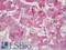 Forkhead Box L2 antibody, LS-B12865, Lifespan Biosciences, Immunohistochemistry paraffin image 