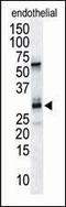 Regulator Of Calcineurin 1 antibody, LS-C100068, Lifespan Biosciences, Western Blot image 