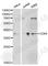 Cyclin Dependent Kinase 6 antibody, A1545, ABclonal Technology, Western Blot image 