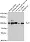 Toll Like Receptor 1 antibody, GTX32924, GeneTex, Western Blot image 