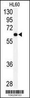 Ubiquitin Specific Peptidase 2 antibody, 61-093, ProSci, Western Blot image 