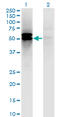 Dihydrolipoamide S-Succinyltransferase antibody, LS-C197055, Lifespan Biosciences, Western Blot image 